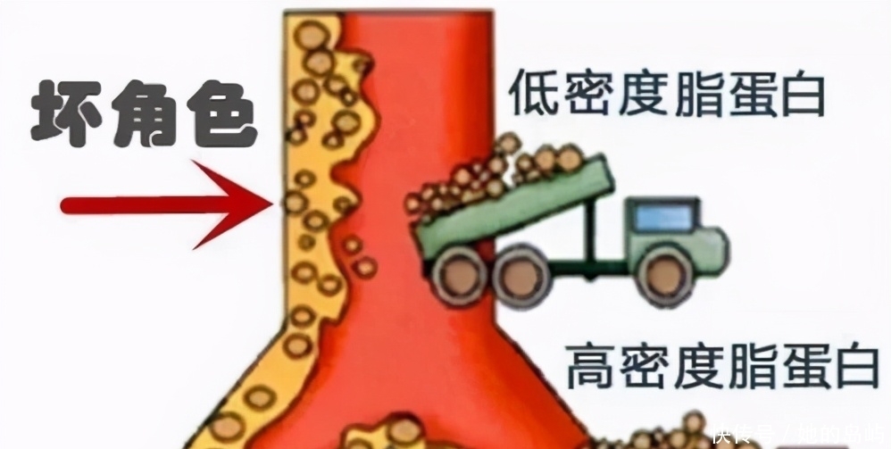 体检发现低密度胆固醇偏高,饮食上要注意什么呢?听听专家怎么说