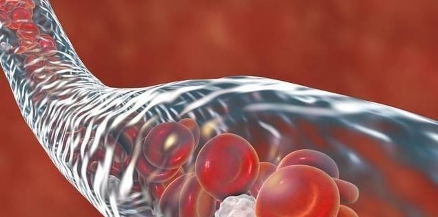 降压|高血压病友不想“肾早衰”,拖累下半生!降压过程中5点别大意