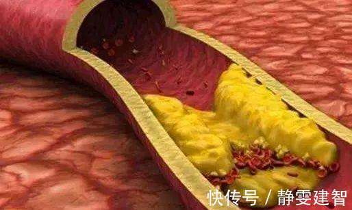 食物|医生常吃5种食物的人,很难得高血脂,可是多数人都不爱吃