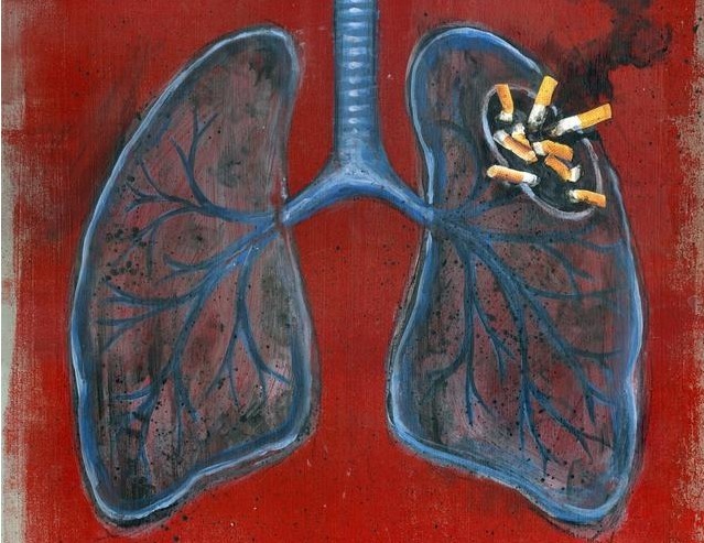 肿瘤|肺癌早期不疼不痒,身体2处持续瘙痒,说明肺受损,是时候养肺了