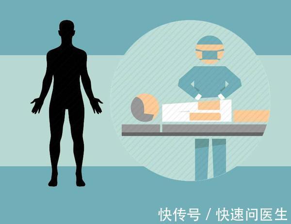 癌细胞|癌细胞转移、扩散前有什么表现?手术难道就不能根治吗?答案来了