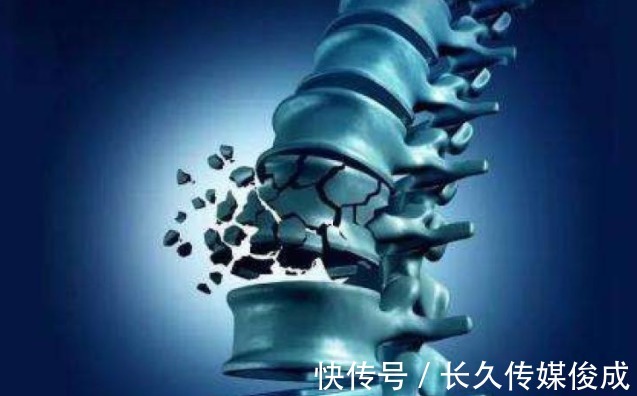 钙质|豆腐是骨质疏松的“发物”?医生:想要骨头强硬,少吃3种食物