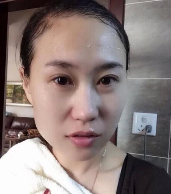 家家都用它,祛斑美白的头号选择,恢复婴儿皮肤。