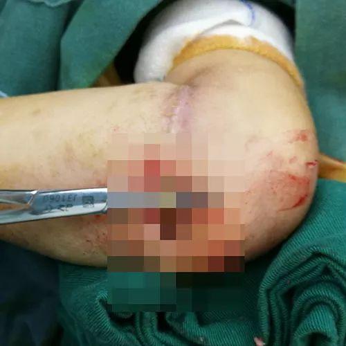 橡皮筋|4岁女孩得怪病,医生检查后,忍不住训斥父母心真大