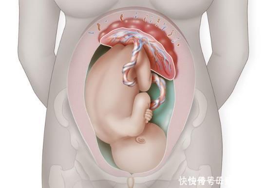 分娩|剖腹产为何要在孕38周而不是40周?别看只差两周,差距不是一点点