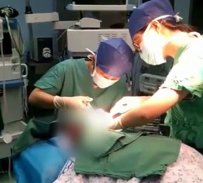 珍珠瘤|女子左耳垂上长了个疙瘩,医院检查后,医生从中取出一颗“珍珠”