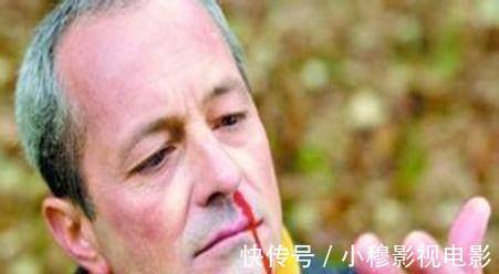 头痛|心内科主任:高血压出现4种情况,当心中风!他不在意已中招!