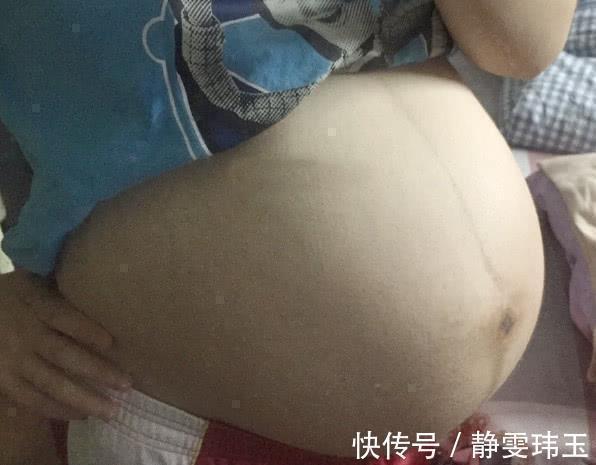 孕妈|孕期安全图鉴:孕妈站、坐、躺、弯腰、上下楼,这些细节都要注意