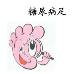 病变|放过他们的双脚,糖尿病足(五)治疗篇