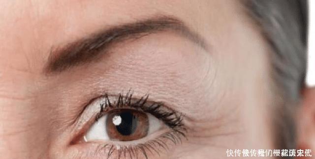 割完“双眼皮”的人,老了之后会变成什么样说出来你可能不信