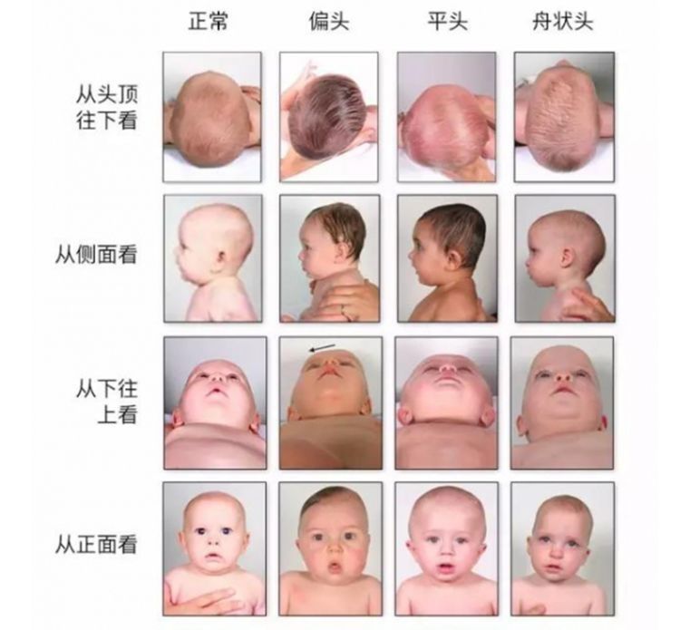 孩子|这种“头型”的孩子,自身携带“高个”基因,中了的父母偷着乐吧