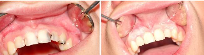 杯子|宝宝超过这个时间戒奶瓶危害大,儿科医生告诉你轻松戒