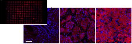 副作用|南开学生团队研发新技术 助癌症患者精准选药