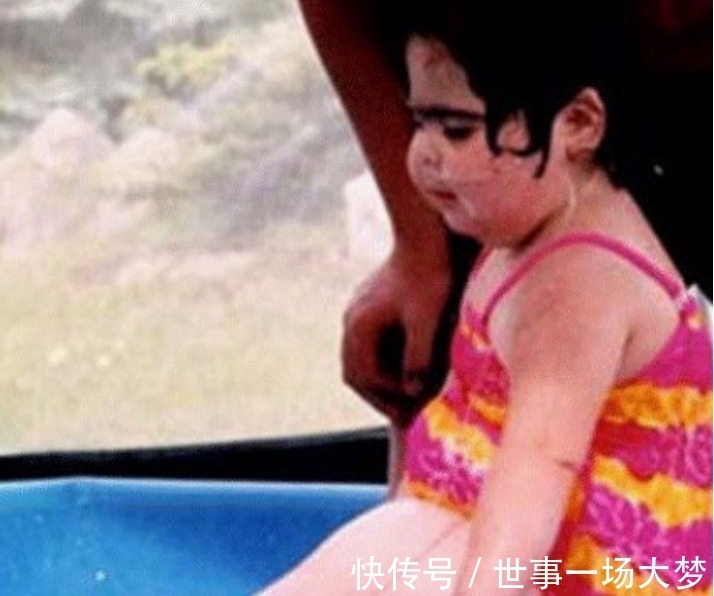 童话故事|还记得那位患“美人鱼病”的人吗?她后来怎么样了?