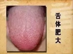 原来祛湿气最厉害的,不是薏米,而是它!