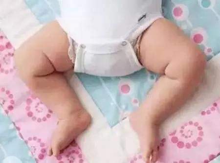 双腿|为什么新生儿总是双腿蜷缩像只小青蛙?