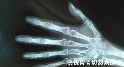 体质|人过中年,若还能有“1细”、“1长”、“1硬”,或许是长寿体质