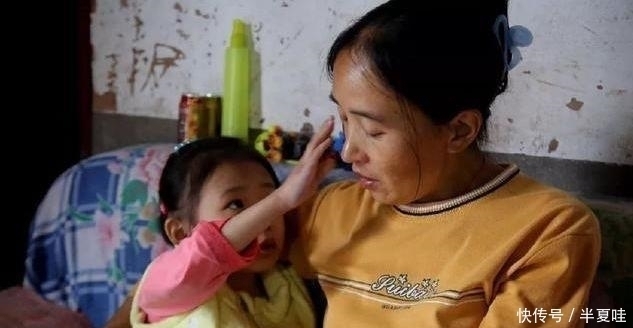 治病|5岁女孩因没钱治病,拖着象腿一样粗的大腿,每天吃止痛片止痛