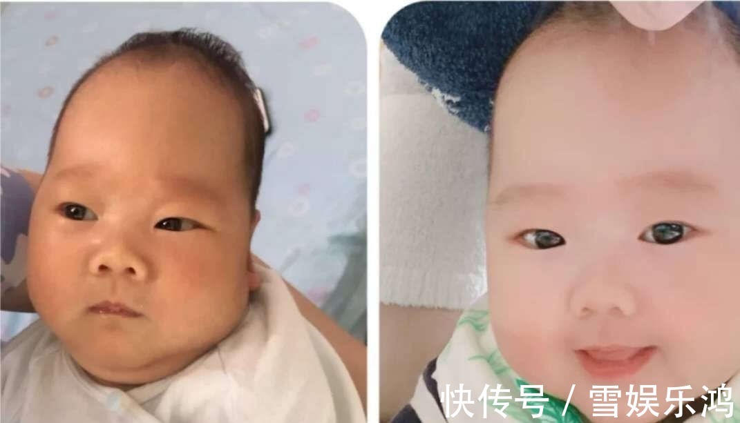 浮肿|新生儿这几个部位丑,反而预示高颜值,宝宝逆袭的我你高攀不起