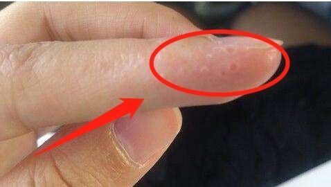 牙结石|牙膏加2物一起用，效果“杠杠的”，老婆也连连称赞，男性来学学