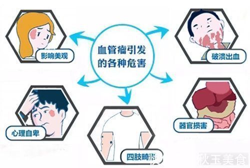 蔓状血管瘤|注意!别忽视,宝宝身上的小红点,可能是血管瘤!