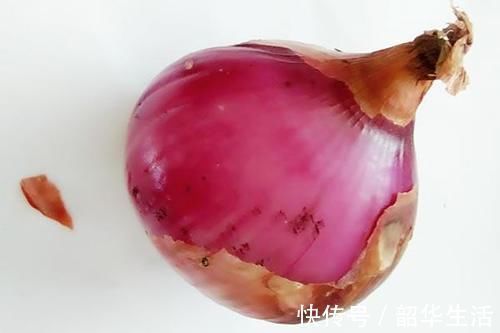 血小板|经常吃洋葱的人,体内不易出现血栓?是真的吗?专家说得很有道理