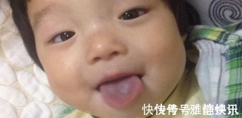 沙棘|孩子积食再顽固,宝妈用2招,轻松去积食,孩子长大个