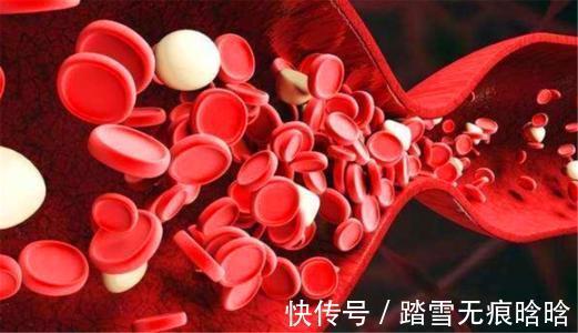 胆固醇|高血脂的“大冤家”被发现了，这1物早晚敞开肚子吃