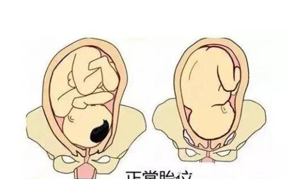 产妇|怀孕后多久,胎位就要固定了?这个孕周前,孕妈还能“调乾坤”