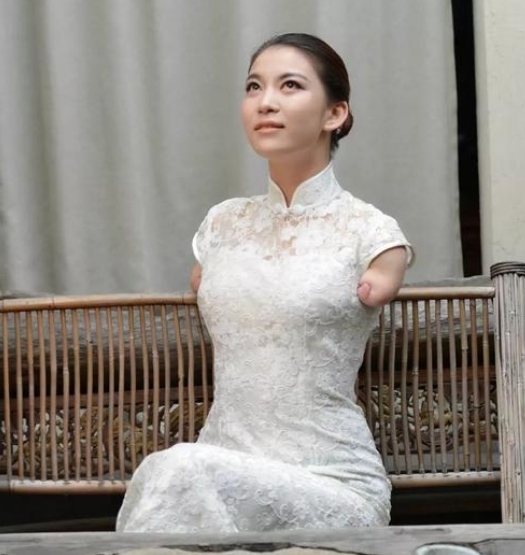 嘉賓|《非誠勿擾》無臂女孩臺上牽手，臺下慘遭拋棄，如今怎么樣了？