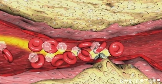 吃花生让血压升,还是降?高血压患者天天吃行吗?看完你就明白了