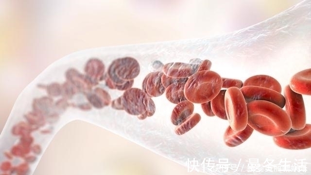 b族维生素|甘油三酯高,退休院士提醒做好6件事,坚持15天,血脂自己降