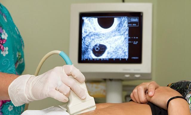 宝爸|孕期最关键的4次产检,就算再忙,宝爸也要陪孕妈一起