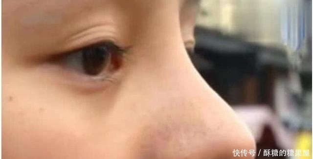 女子|女子花3万整鼻子整失败,医生:90分的鼻子出现在60分的脸上