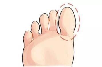 按摩|低头摸脚,百病治好,很多病在脚上都有开关!只是你不知道!