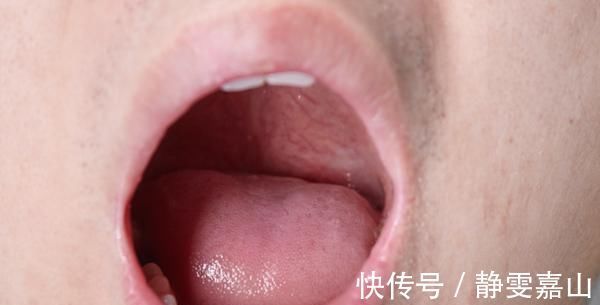 鬓角|身体好不好,看头发就知道,白发的生长位置,暴露了你的身体情况