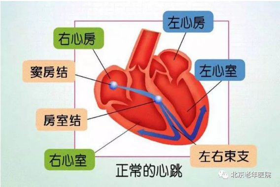 心律失常|期前收缩——早搏知多少？