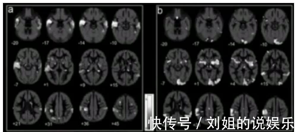 危险因素|影响胎儿“脑发育”的4个因素，一定要注意了！