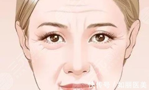 治疗 手术除皱多少钱,怎么做?效果咋样?超全抗衰攻略助你摆脱年龄数字!