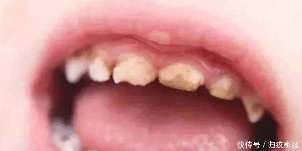 如果用牙齿来判断颜值的话，大家觉得问题容易出现在哪里呢？
