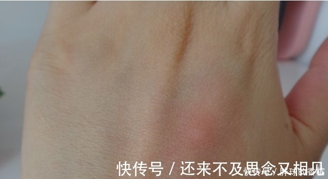 肉芽肿|血糖高不高先看手,若没有3个“表现”恭喜,你的血糖很稳定