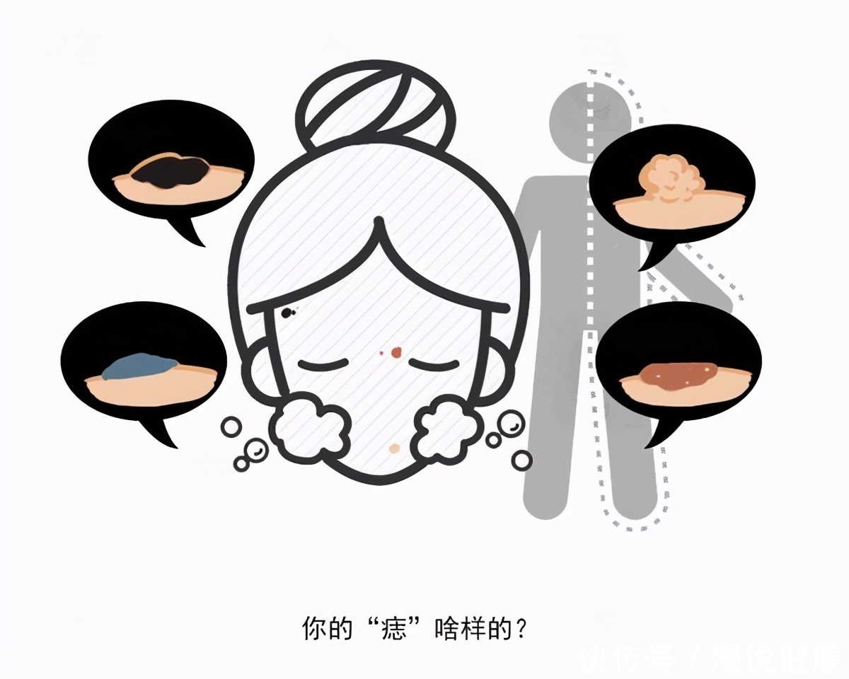 伤口|6年前的一个小伤口,却没想到演变成癌?这究竟是怎么一回事?