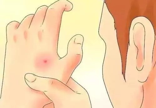 藿香正气水|藿香正气水的18种妙用！