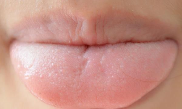 牙齿|吃饭时,总咬到舌头或腮帮子并不是馋肉了,或是大脑发出的预警