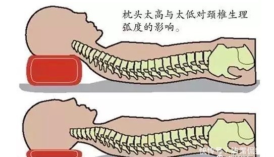 颈椎|枕头不适合也会导致颈椎病!教你如何挑选合适的枕头来保护颈椎!