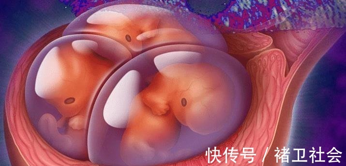 孕妈|孕妇怀孕3个月,肚子大到行动不便,孕检后一家人很纠结