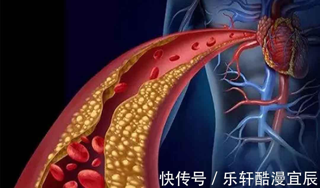 肉类|担心糖尿病、高血压无花果吃出4大功效，降胆固醇也在内！