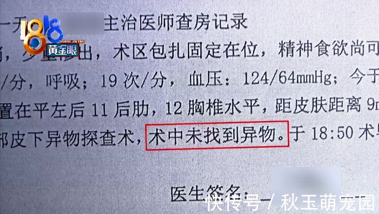 部件|吸脂术探头留在姑娘体内,院方两次手术都没取出