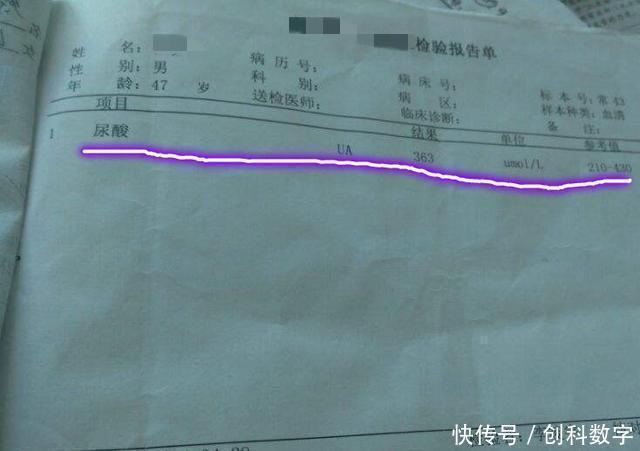 养肝|他喝酒50年，自称不怕痛风，秘诀只有1个，尿酸保持得好