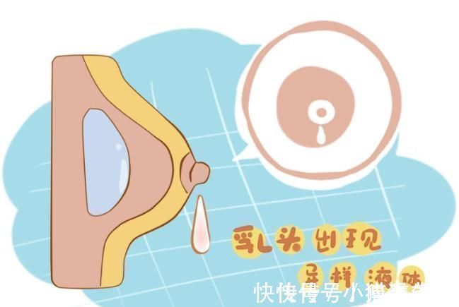 癌症|女性乳腺癌发作前，身体会发出这6种异常信号，越早发现越好